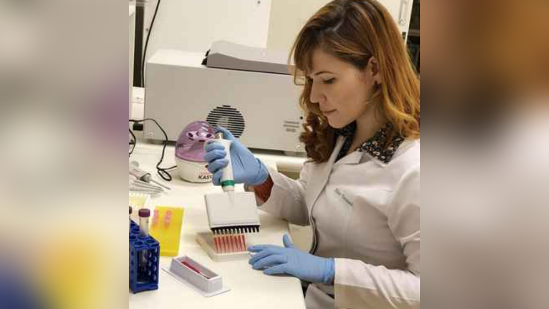 Teste desenvolvido por pesquisadores da UFMG é capaz de detectar quatro tipos de dengue