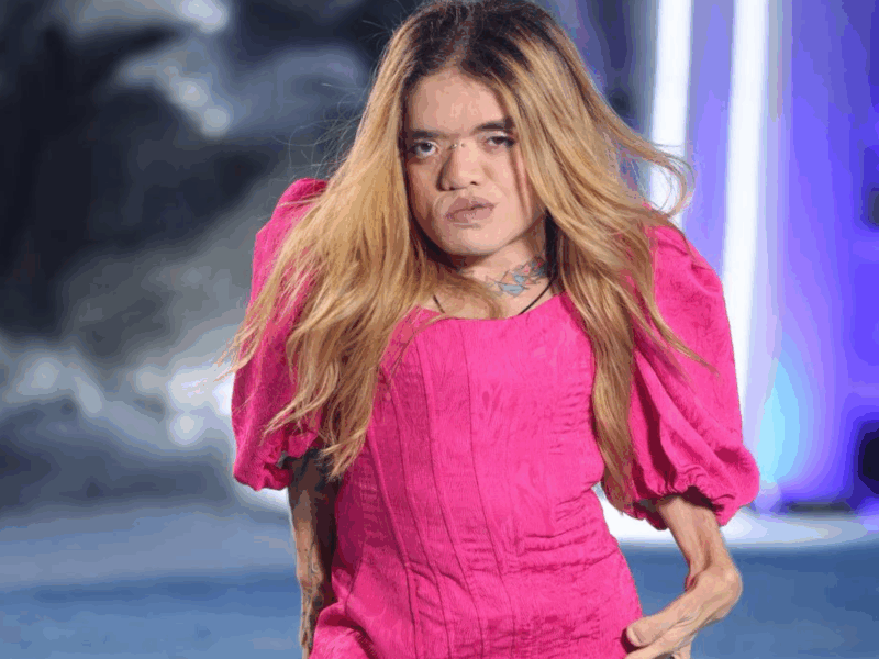 Tá na moda ser autista agora?